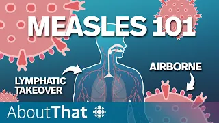 Measles: Understanding the most contagious preventable disease | About That