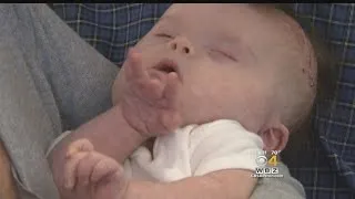 Boston Children's Hospital Surgeons Perform Brain Surgery On Baby