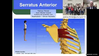 Cirurgia Escapular para Distrofia Muscular FSH