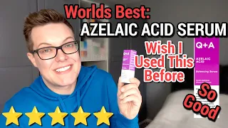 Official: THE BEST AZELAIC ACID SERUM - Brighter Skin Guaranteed