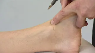 How to Locate Acupuncture Points (LV4)