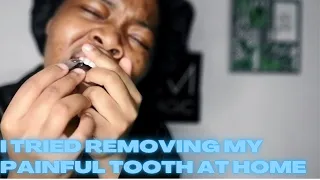 REMOVING MY PAINFUL TOOTH AT HOME