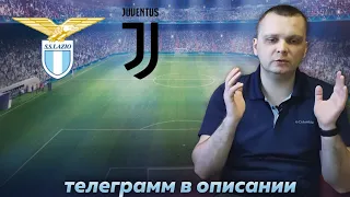 Лацио Ювентус прогноз/Прогнозы на футбол сегодня 23.4.24