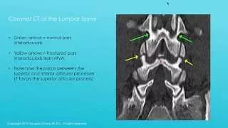 Spinal Palp Midterm X ray Lecture fall15