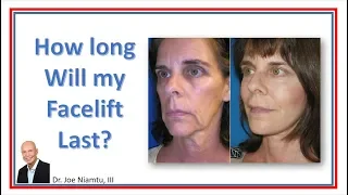 How Long Will My Facelift Last?