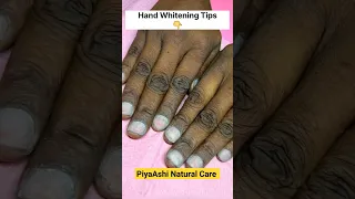Viral Hand Whitening: Natural Remedies for Brighter, Radiant Skin!