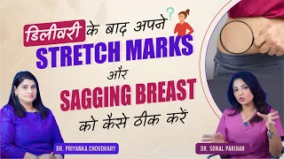 डिलीवरी के बाद अपने Stretch marks और Sagging breast को कैसे ठीक करे | PART 1| Dr.Sonal & Dr.Priyanka