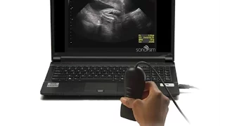 Ultrasound Video Challenge - Obstetrics