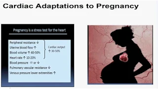 “Spontaneous Coronary Artery Dissection (SCAD)” by Farshad Forouzandeh, MD, PhD, FACC, FSCAI