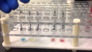 Blood Bank-Forward and Reverse ABORh Blood Typing (Tube method)