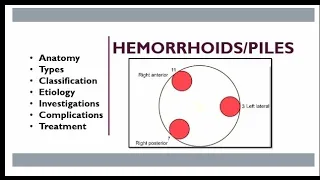 Hemorrhoids (Piles)- Anal cushions, types and classification, Causes, diagnosis and treatment