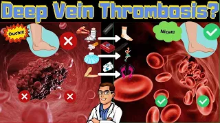 Deep Vein Thrombosis [Blood Clot in Leg or Foot vs. Leg Swelling?]