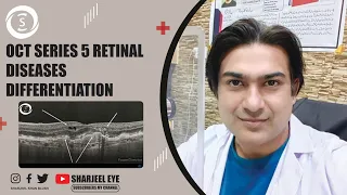 OCT series 5 retinal diseases differentiation