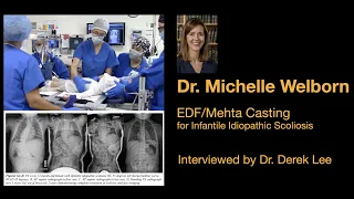 Dr. Michelle Welborn, EDF/Mehta Casting for Infantile Idiopathic Scoliosis, with Dr. Derek Lee