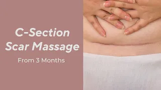 C- Section Scar Massage: From 3 Months