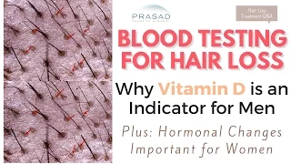 Testing for Hair Loss - Importance of Vitamin D, and Why Genetics are Major Cause of Hair Loss