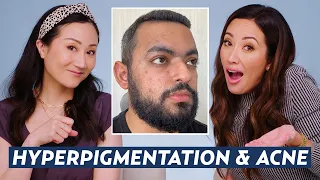 How to Treat Acne & Fade Hyperpigmentation: Dermatologist Reacts to Ibrahim’s Skincare Routine