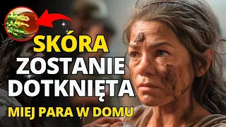 😲 NOWA PLAGA DOTKIE SKÓRĘ, MIEJ PARA W DOMU | Przesłanie de Jezusa