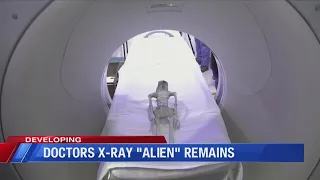 Doctors X-Ray 'Alien' remains