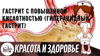 Гастрит с повышенной кислотностью (Гиперацидный гастрит)