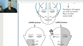 Anatomy of head and neck module in Arabic 78 (Facial nerve, part 3) , by Dr. Wahdan