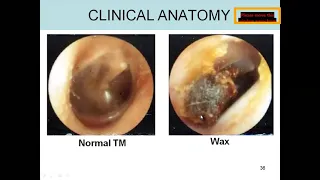 Ear Anatomy Dr Shabana Head and neck Lectures