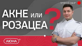 Акне или розацеа? Как различить, сходство и отличия,  подходы к лечению