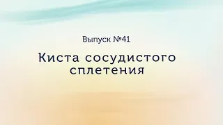 Kиста сосудистого сплетения