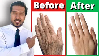 2 Fast Remedies for Dry and Wrinkled Hands THAT WORK