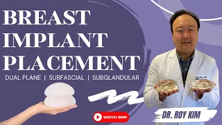 Best Placement for Breast Implants: Exploring Dual Plane, Subfascial, and Subglandular