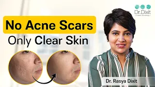 Acne Scar Types & Treatments | Acne Scar Treatment by Dermatologist | Dr. Rasya Dixit