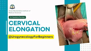 Cervical Elongation | Supravaginal Elongation of Cervix Versus Infravaginal Elongation of Cervix