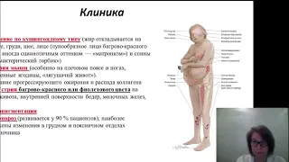 Эндокринология 6. Гормонально-активные опухоли надпочечников