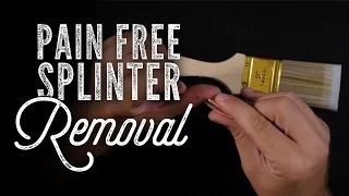 How To Painlessly Remove Splinters From Your Skin | Drew & Jonathan