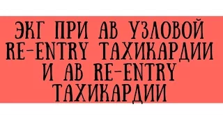 ЭКГ при АВ узловой реципрокной re-entry тахикардии (АВРТ, АВУРТ) - meduniver.com