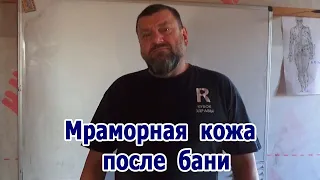 Олег Рябиков - Лекарь "Мраморная кожа после бани"