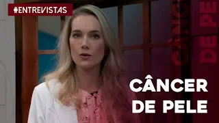 Saiba tudo sobre o câncer de pele