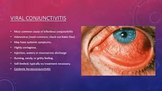 Conjunctivitis