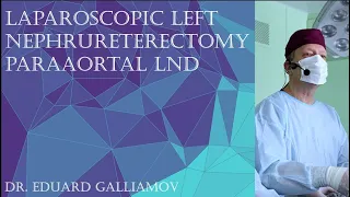 Left nephrureterectomy paraaortal LND / Лапароскопическая нефруретерэктомия  слева