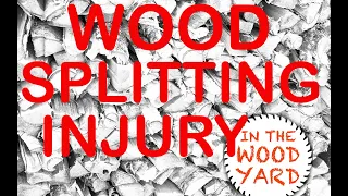 #215 - Splitting Firewood while injured