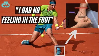 Expert Explains Rafa Nadal Foot Injections & “Numb Foot” | How Risky?