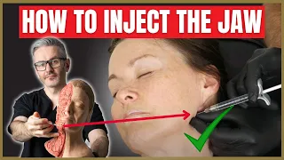 Jawline Injection Techniques | Injecting the Jaw Safely