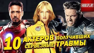 10 Актеров, получивших серьезные травмы на съемках!