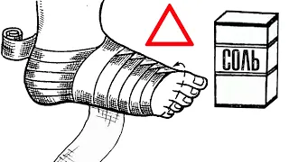Солевые Повязки Творят Чудеса. Почему об Этом Мало Кто Знает?