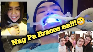 Nag pa Brace! Road to a Perfect Smile (Charrrr!😂) | JEROMINA BENDAÑA