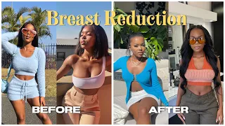 MY BREAST REDUCTION: cost (no medical aid), pain, recovery...