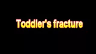 What Is The Definition Of Toddler's fracture