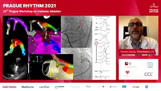 Prague Rhythm 2021, DAY 1, SESSION 2 - Ventricular arrhythmias