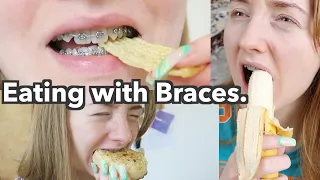 Everything I ate | First week of Braces