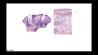 Essential dermatopathology part 3